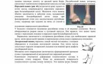 Лекция № 15 переломы. Вывихи