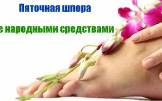 Лечение пяточной шпоры народными средствами
