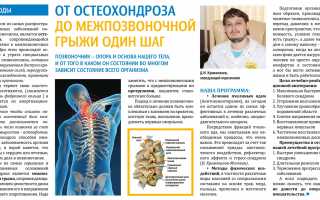 Главные причины развития шейного остеохондроза