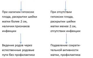 Преждевременные роды