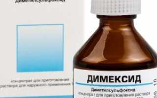 Применение Димексида для лечения пяточной шпоры
