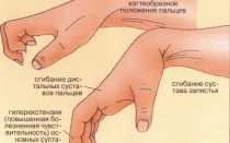 Ушиб костяшки кулака: лечение других видов травм, типичные повреждения и меры первой помощи
