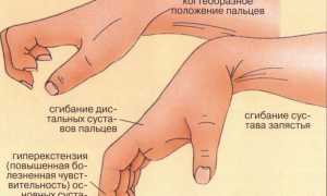 Ушиб костяшки кулака: лечение других видов травм, типичные повреждения и меры первой помощи