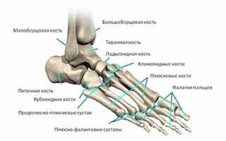 Какими последствиями могут быть опасны переломы плюсневых костей?