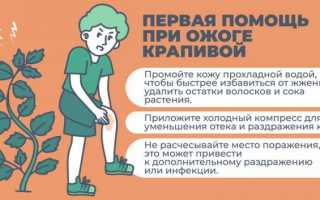 Ожог от крапивы у ребенка и взрослого: польза или вред