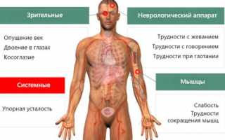 Лечение и прогноз при миастении