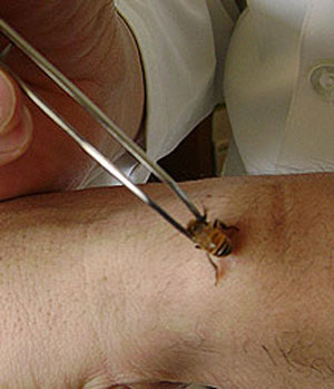 apiterapia