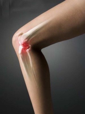 deform-osteoar2