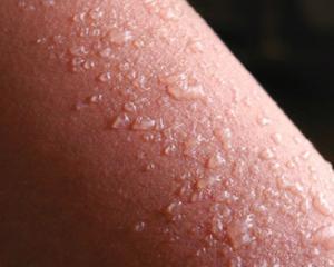 dermatoskl