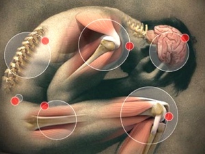 fibromialgija2