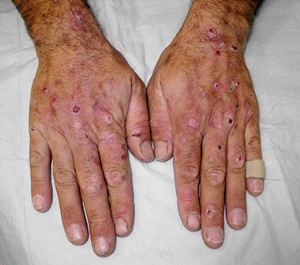 gemohr2