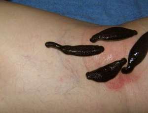 girudoter3