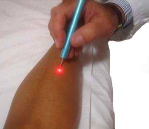 laser-sz