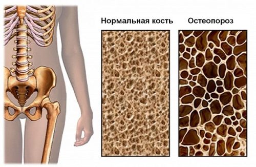 osteop-sb2