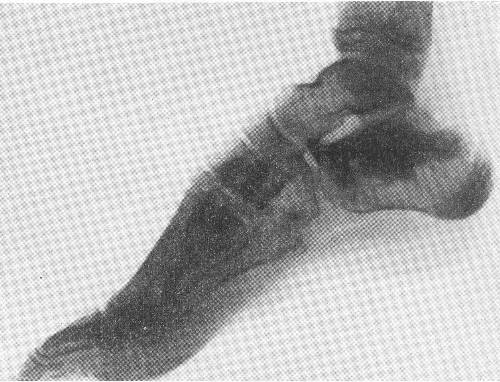 osteopoik2