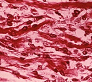 rabdomios2