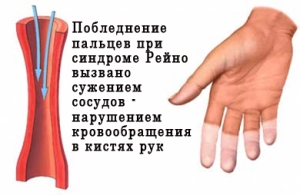 reino2