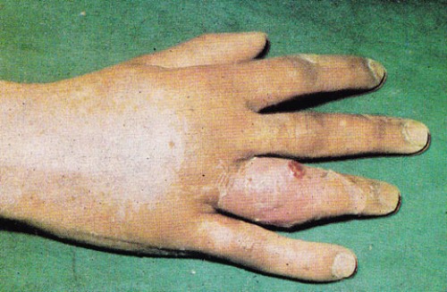 sus-panar