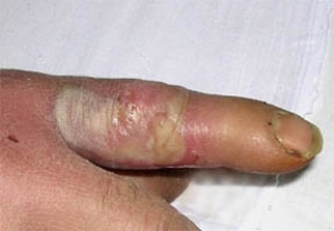 sus-panar2