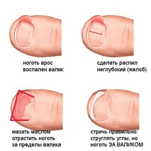 t4_1236935