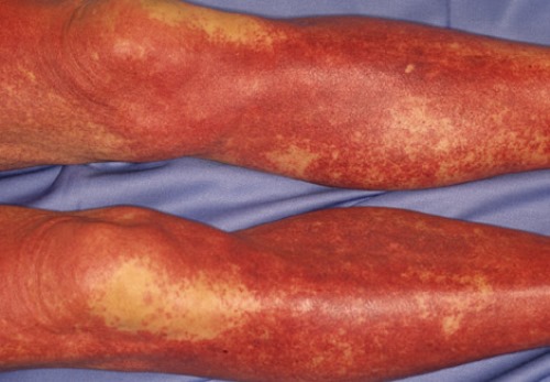 Dermatology Image by Yasusi Suzumura